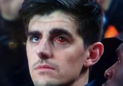 Thibaut Courtois rassure tout le monde à propos de son oeil rouge